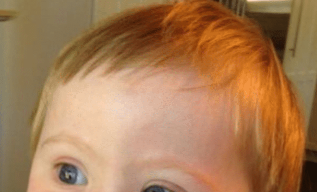 An Extra Chromosome Charlie