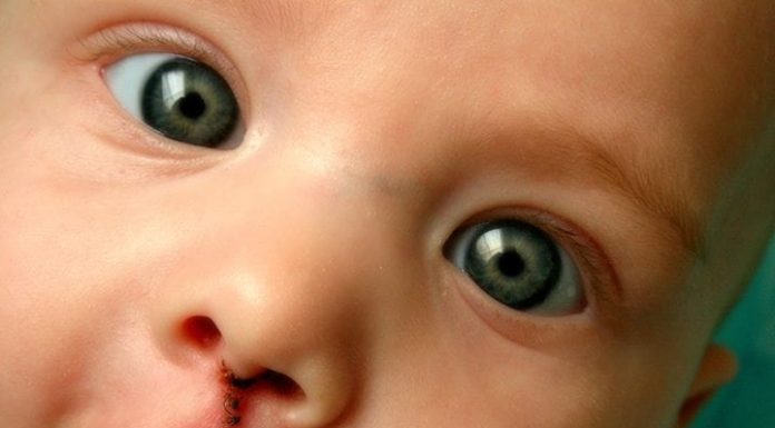 Life is Perfectly Imperfect: 1 in 650