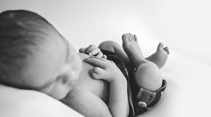 1 in 350 Children are Born with Polydactyly: My Newborn Son is One of Them