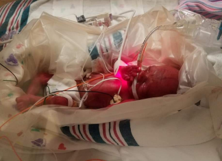 1 Pound, 7 Ounces: Life After the NICU nicu