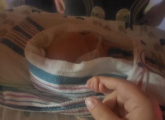 Prematurity Leaves Scars (You Just Can’t See Them All) prematurity