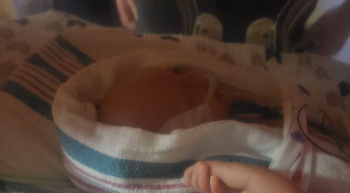 Prematurity Leaves Scars (You Just Can’t See Them All) prematurity