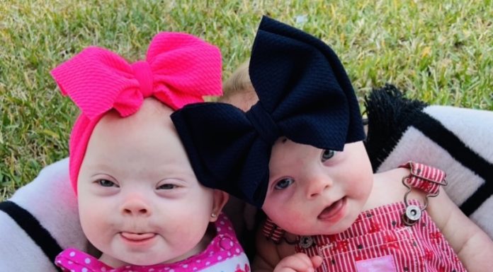 One (or Two!) In a Million: ‘Rare’ Twins Born With Down Syndrome down syndrome