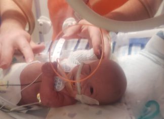 How the NICU Changes You nicu