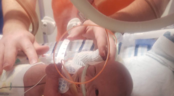 How the NICU Changes You nicu