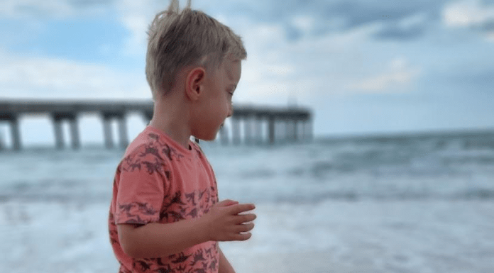 The Awkward Question and Lifesaving Choice craniosynostosis