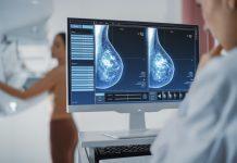 How Having Dense Breasts Can Affect Breast Cancer Risk