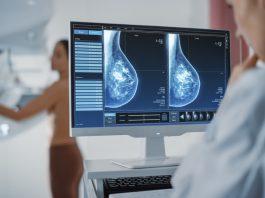 How Having Dense Breasts Can Affect Breast Cancer Risk