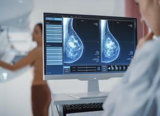 How Having Dense Breasts Can Affect Breast Cancer Risk