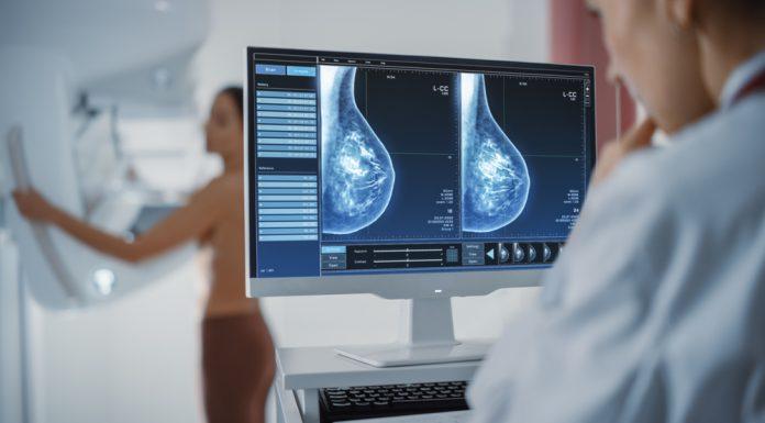 How Having Dense Breasts Can Affect Breast Cancer Risk