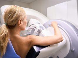 A Wake-Up Call: Younger Women Facing Rising Cancer Rates cancer rates