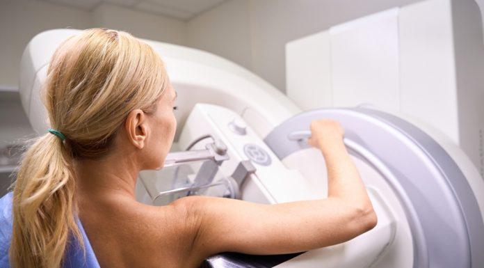 A Wake-Up Call: Younger Women Facing Rising Cancer Rates cancer rates
