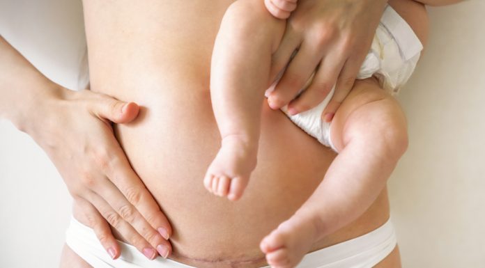 What to Expect When You Aren’t Expecting the Unexpected: My Emergency C-Section Story emergency c-section